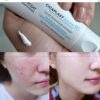Cách dùng cicaplast baume b5
