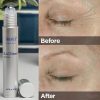 Kem Dưỡng Mắt Obagi Elastiderm Eye