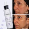 serum image iluma intense facial illuminator